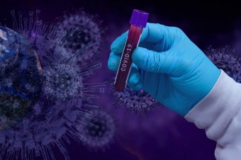 Pracodawcy coraz częściej testują swoich pracowników na koronawirusa