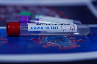 Czy pracodawca może zmusić pracownika do testu na COVID-19?